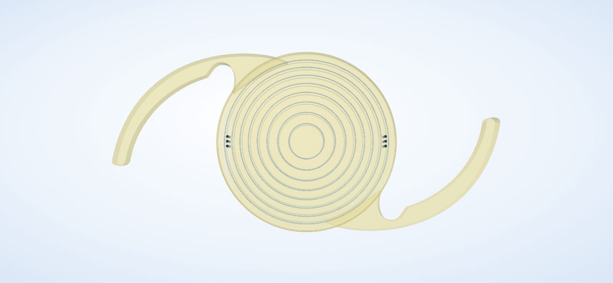 An illustrative multifocal intraocular lens with concentric optical rings, curved supporting arms, yellow tint and toric axis marks