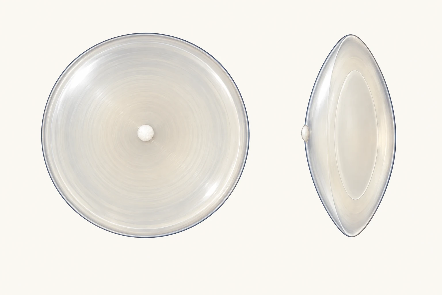 Front view and side optical section showing a small anterior polar white spot at the front, left-hand pole of an otherwise clear lens.
