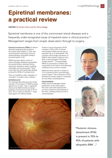 First page of Epiretinal membranes: a practical review