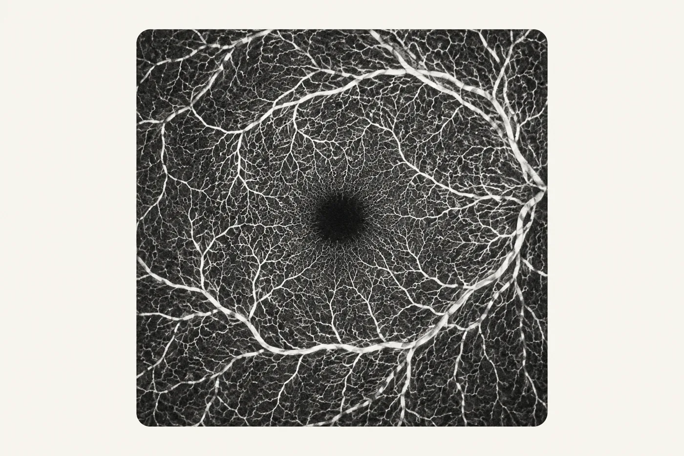 OCT angiogram: a fine white network of retinal capillaries around a dark central zone.